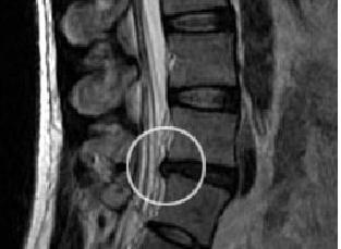 ero MRI: n ja CT: n välillä