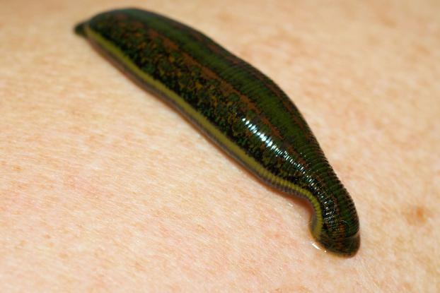 hoito leeches: mikä on käyttö ja haittaa